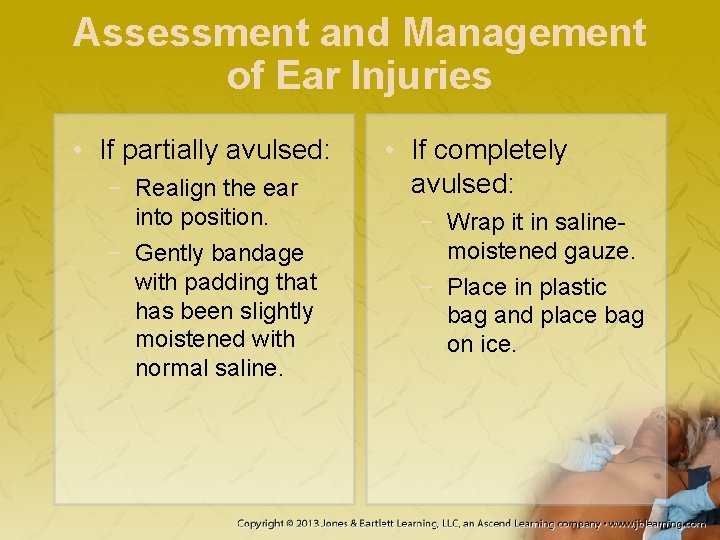 Assessment and Management of Ear Injuries • If partially avulsed: − Realign the ear