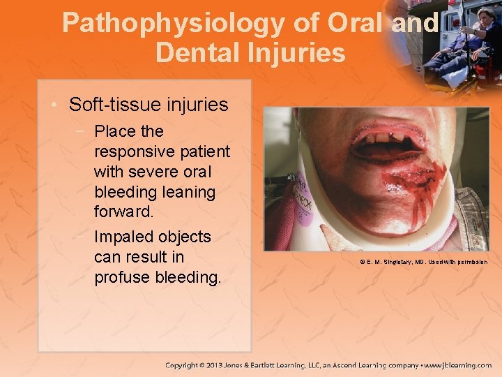 Pathophysiology of Oral and Dental Injuries • Soft-tissue injuries − Place the responsive patient