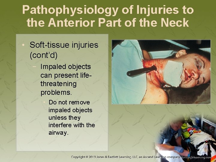 Pathophysiology of Injuries to the Anterior Part of the Neck • Soft-tissue injuries (cont’d)