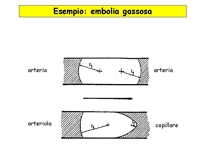 Esempio: embolia gassosa arteria arteriola capillare 