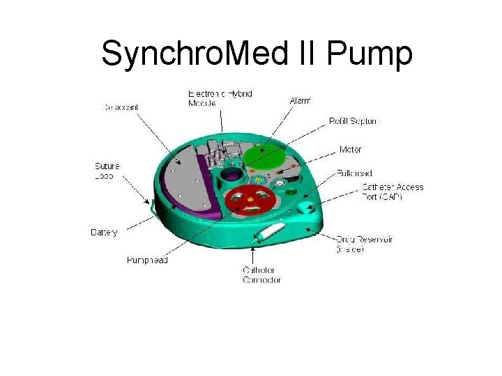 Synchro. Med II Pump 