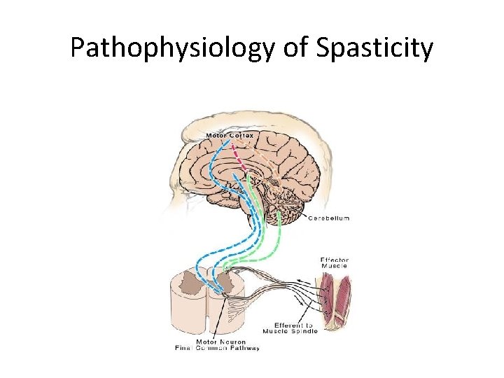 Pathophysiology of Spasticity 