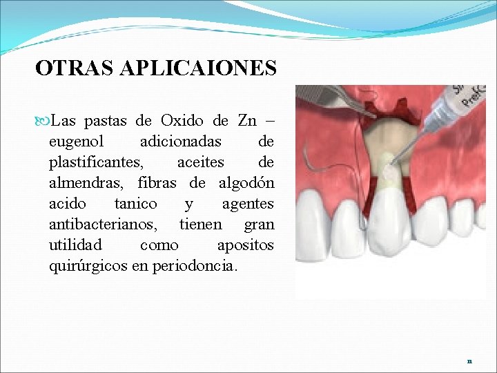 OTRAS APLICAIONES Las pastas de Oxido de Zn – eugenol adicionadas de plastificantes, aceites