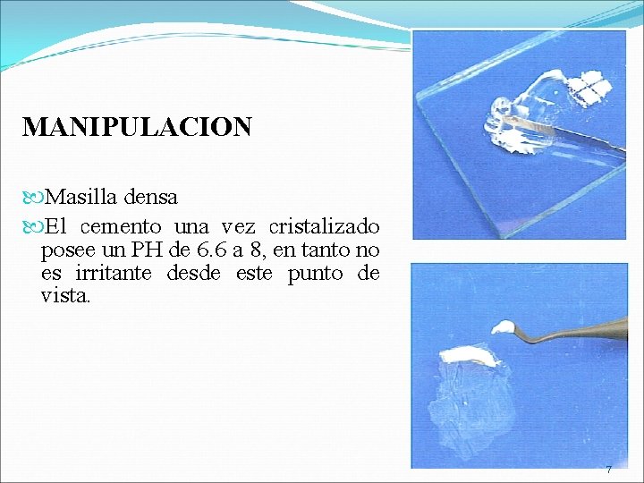 MANIPULACION Masilla densa El cemento una vez cristalizado posee un PH de 6. 6