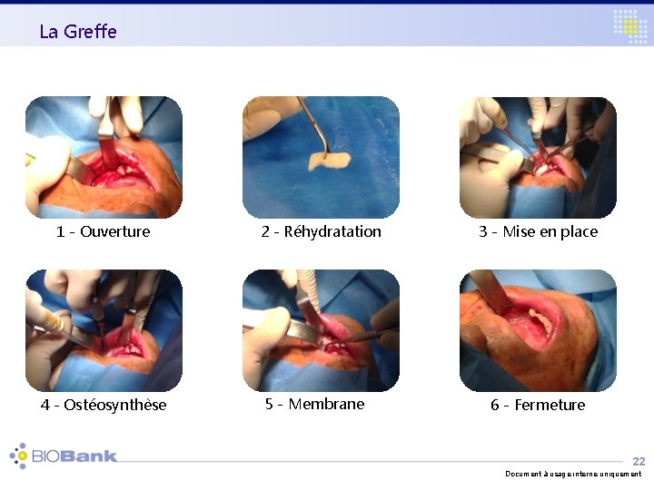 La Greffe 1 - Ouverture 4 - Ostéosynthèse 2 - Réhydratation 5 - Membrane