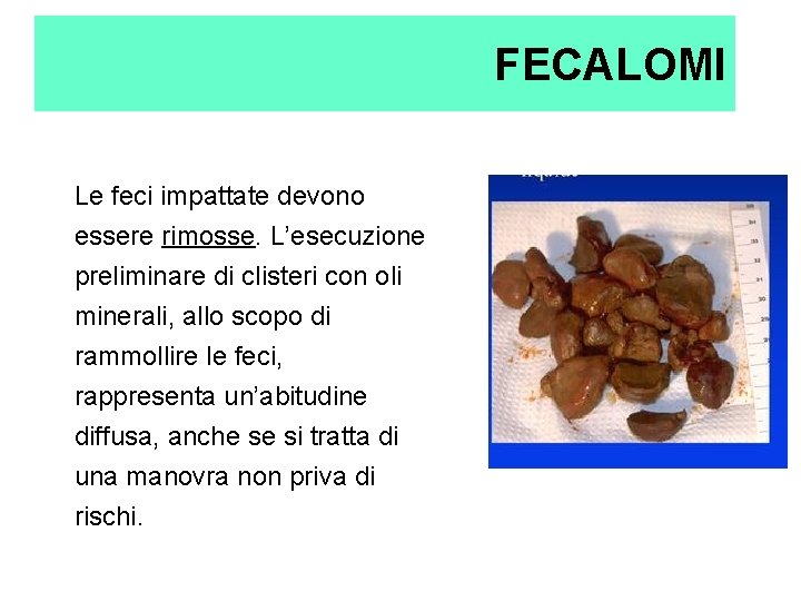 FECALOMI Le feci impattate devono essere rimosse. L’esecuzione preliminare di clisteri con oli minerali, FECALOMI Le feci impattate devono essere rimosse. L’esecuzione preliminare di clisteri con oli minerali,