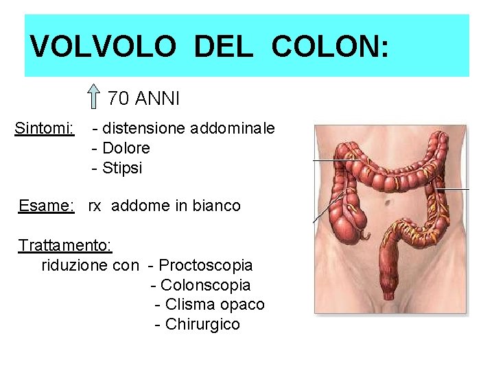 VOLVOLO DEL COLON: 70 ANNI Sintomi: - distensione addominale - Dolore - Stipsi Esame: VOLVOLO DEL COLON: 70 ANNI Sintomi: - distensione addominale - Dolore - Stipsi Esame: