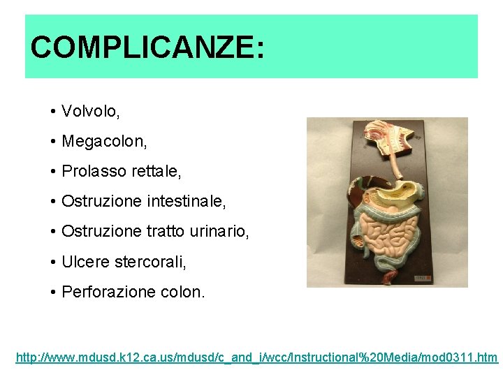 COMPLICANZE: • Volvolo, • Megacolon, • Prolasso rettale, • Ostruzione intestinale, • Ostruzione tratto COMPLICANZE: • Volvolo, • Megacolon, • Prolasso rettale, • Ostruzione intestinale, • Ostruzione tratto