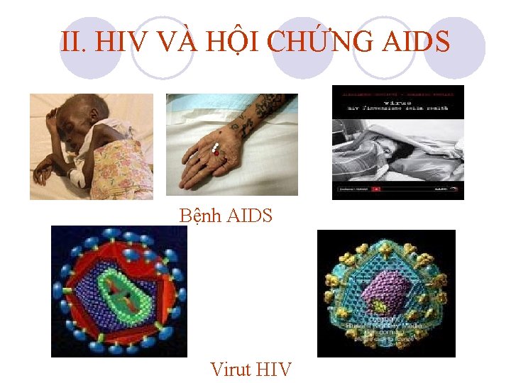 II. HIV VÀ HỘI CHỨNG AIDS Bệnh AIDS Virut HIV II. HIV VÀ HỘI CHỨNG AIDS Bệnh AIDS Virut HIV