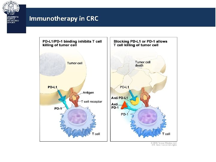 Immunotherapy in CRC 