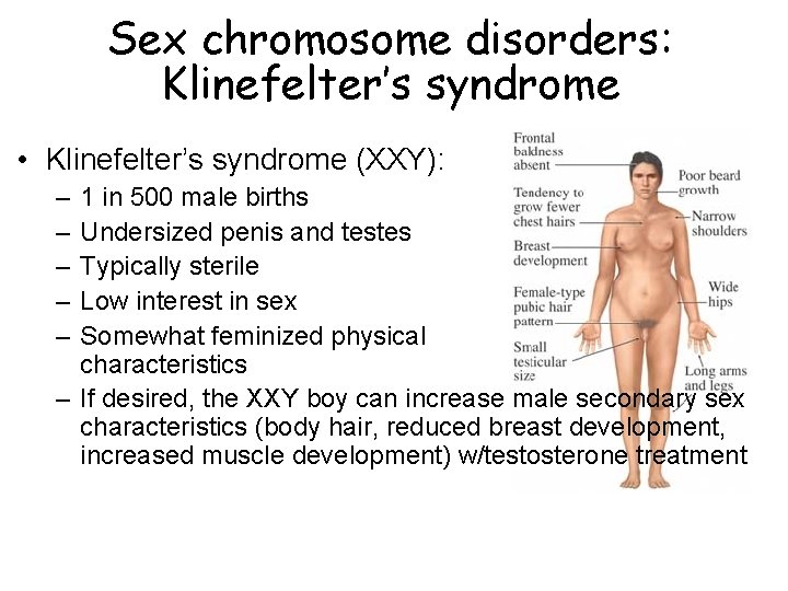 Sex chromosome disorders: Klinefelter’s syndrome • Klinefelter’s syndrome (XXY): – – – 1 in