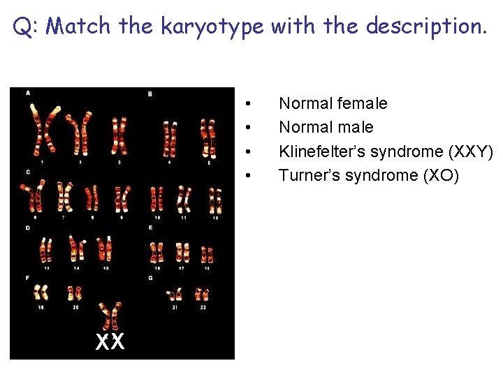 Q: Match the karyotype with the description. • • XX Normal female Normal male