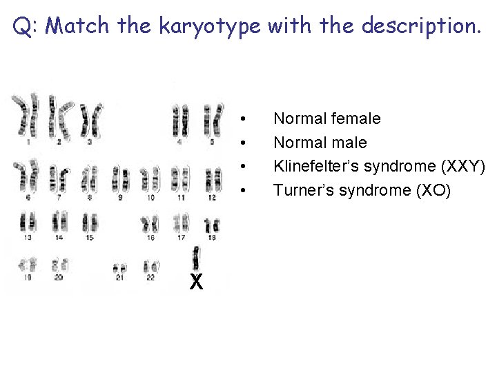 Q: Match the karyotype with the description. • • X Normal female Normal male