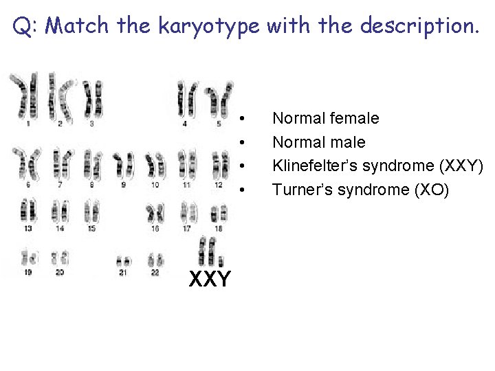 Q: Match the karyotype with the description. • • XXY Normal female Normal male