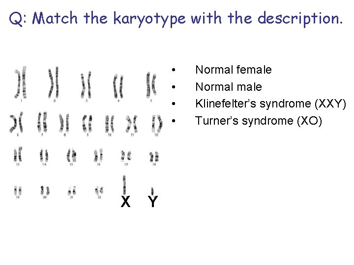 Q: Match the karyotype with the description. • • X Y Normal female Normal