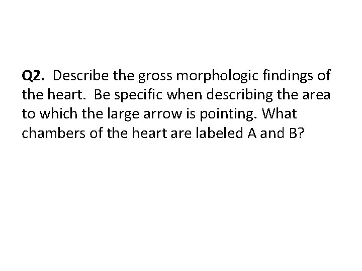 Q 2. Describe the gross morphologic findings of the heart. Be specific when describing
