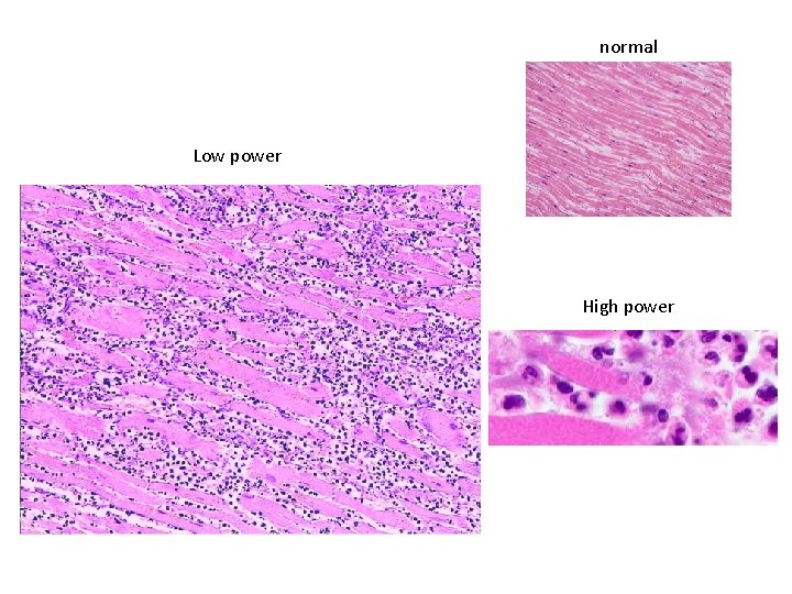 normal Low power High power 