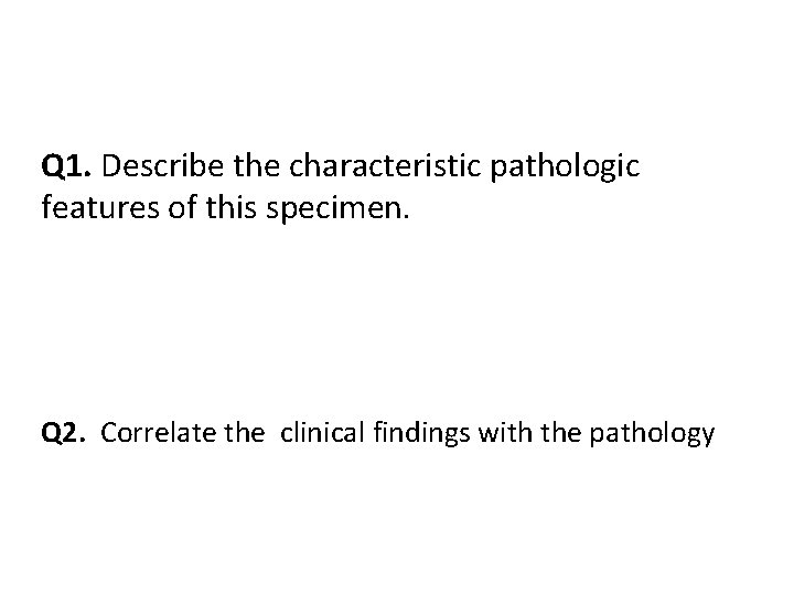 Q 1. Describe the characteristic pathologic features of this specimen. Q 2. Correlate the