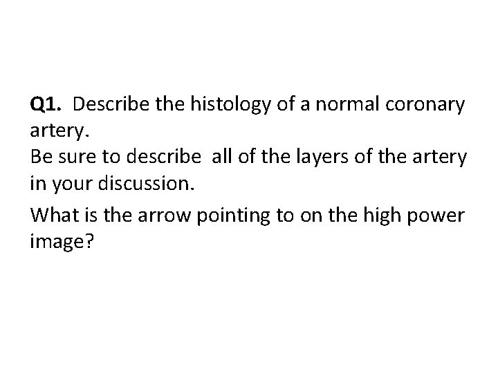 Q 1. Describe the histology of a normal coronary artery. Be sure to describe