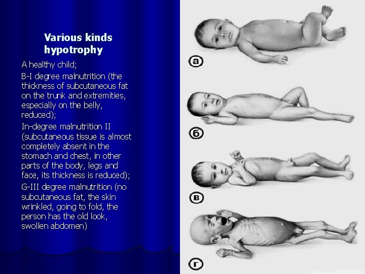 SCARCE STATUS AT CHILDREN DYSTROPHY The lecturer professor