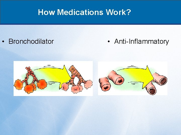 How Medications Work? • Bronchodilator • Anti-Inflammatory 