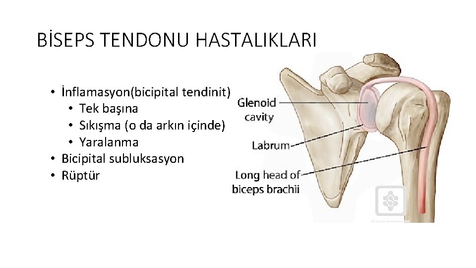 BİSEPS TENDONU HASTALIKLARI • İnflamasyon(bicipital tendinit) • Tek başına • Sıkışma (o da arkın