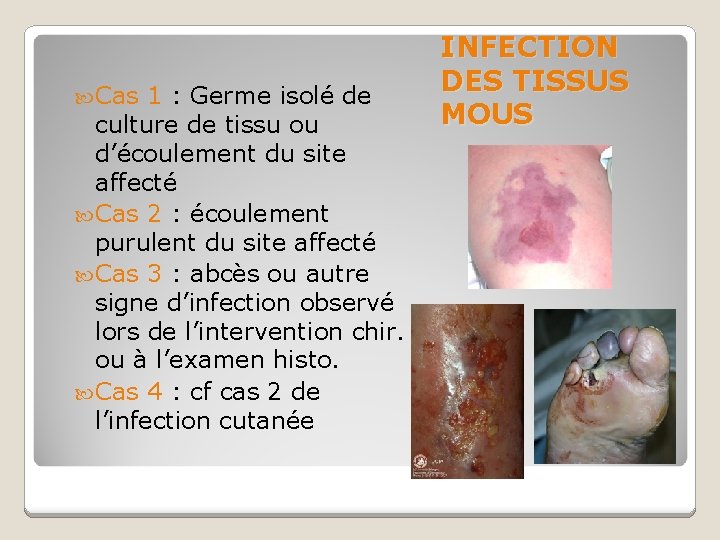  Cas 1 : Germe isolé de culture de tissu ou d’écoulement du site