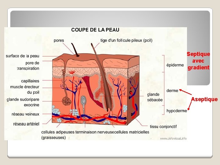 Septique avec gradient Aseptique 