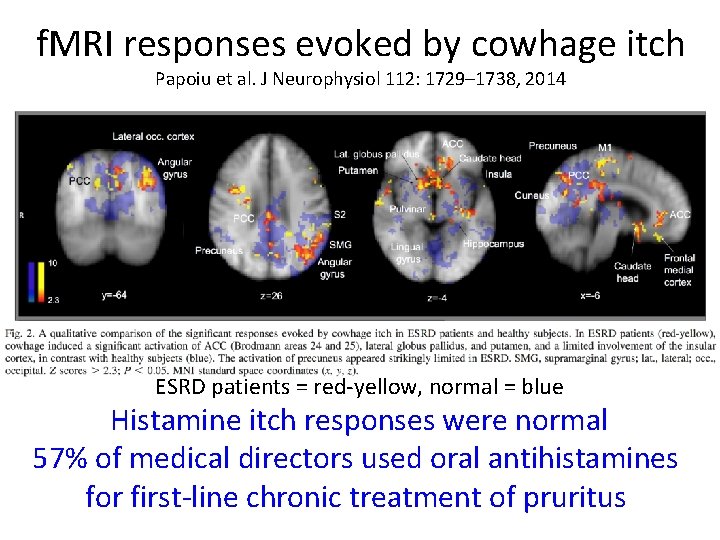 f. MRI responses evoked by cowhage itch Papoiu et al. J Neurophysiol 112: 1729–