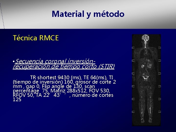 Material y método Técnica RMCE • Secuencia coronal inversiónrecuperación de tiempo corto (STIR) TR