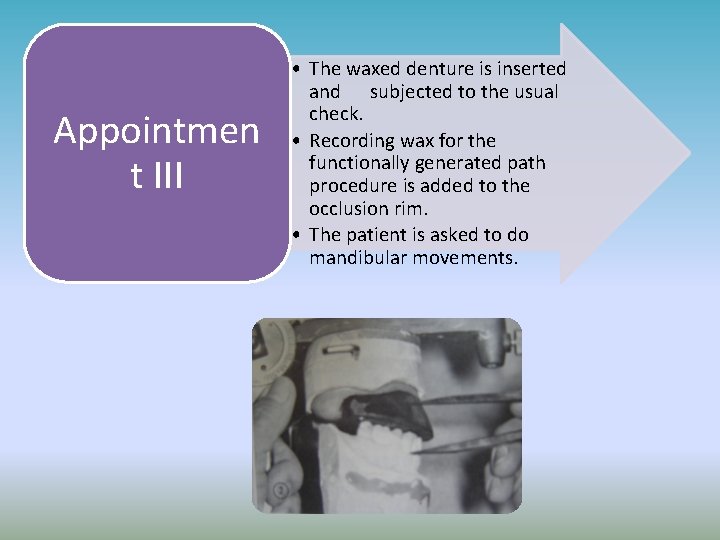 Appointmen t III • The waxed denture is inserted and subjected to the usual