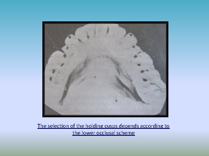 The selection of the holding cusps depends according to the lower occlusal scheme 