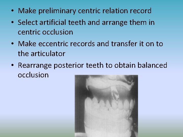  • Make preliminary centric relation record • Select artificial teeth and arrange them