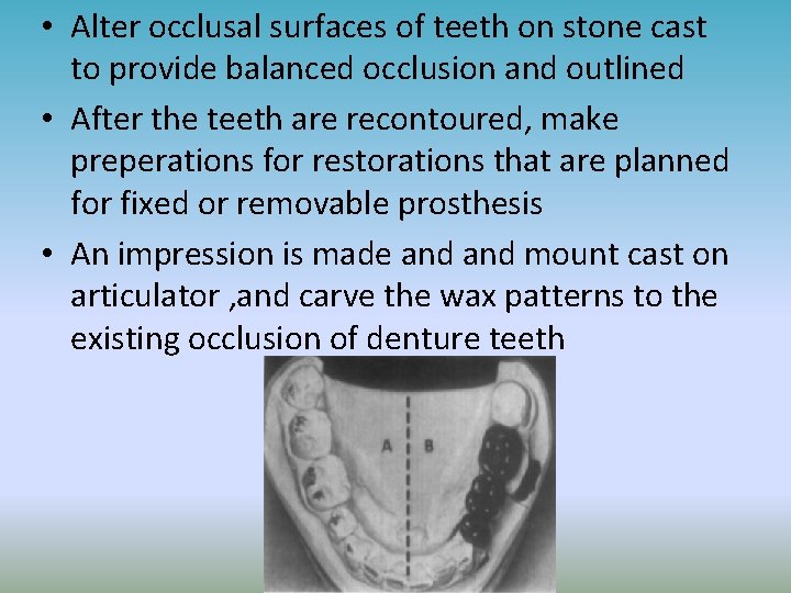  • Alter occlusal surfaces of teeth on stone cast to provide balanced occlusion