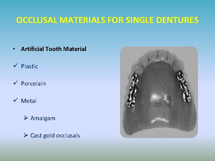 OCCLUSAL MATERIALS FOR SINGLE DENTURES • Artificial Tooth Material ü Plastic ü Porcelain ü