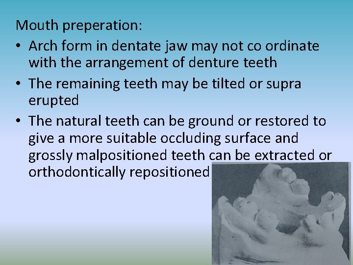 Mouth preperation: • Arch form in dentate jaw may not co ordinate with the