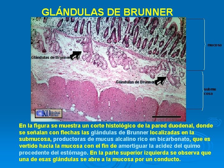 GLÁNDULAS DE BRUNNER -------- mucosa Glándulas de Brunner -------Glándulas de Brunner submu cosa -------