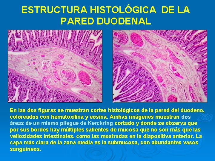 ESTRUCTURA HISTOLÓGICA DE LA PARED DUODENAL En las dos figuras se muestran cortes histológicos