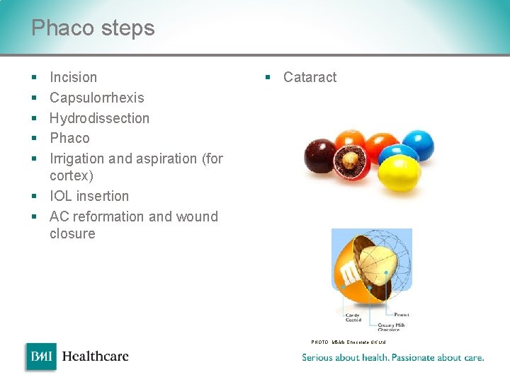 Phaco steps § § § Incision Capsulorrhexis Hydrodissection Phaco Irrigation and aspiration (for cortex) Phaco steps § § § Incision Capsulorrhexis Hydrodissection Phaco Irrigation and aspiration (for cortex)