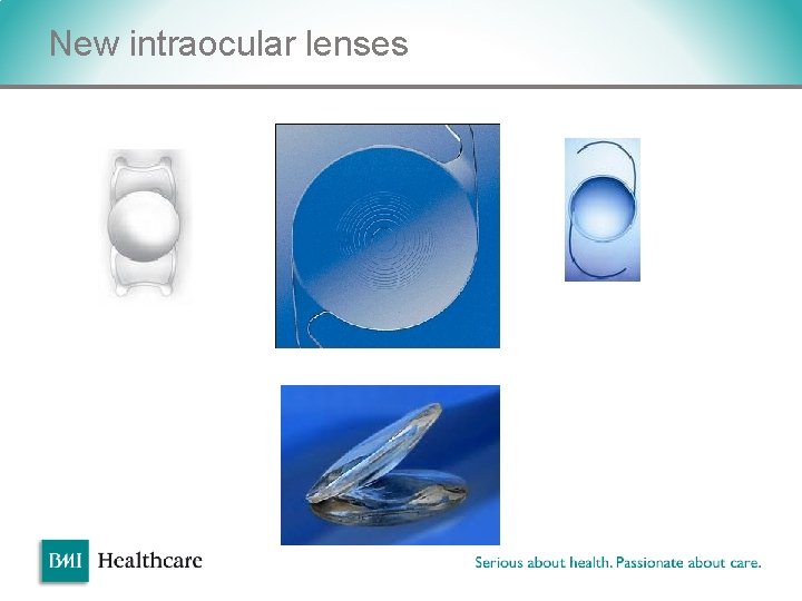 New intraocular lenses v New intraocular lenses v