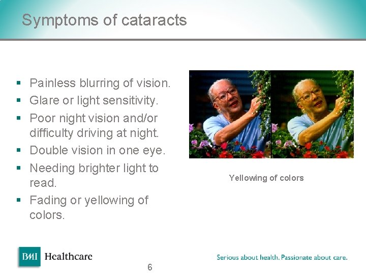 Symptoms of cataracts § Painless blurring of vision. § Glare or light sensitivity. § Symptoms of cataracts § Painless blurring of vision. § Glare or light sensitivity. §