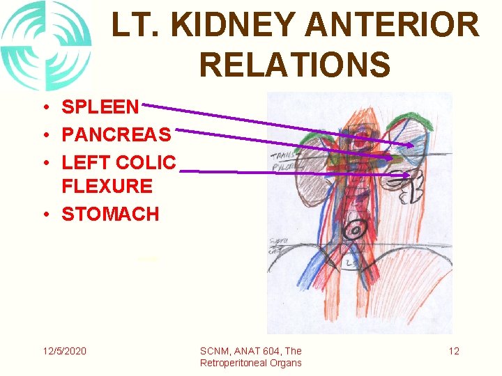 LT. KIDNEY ANTERIOR RELATIONS • SPLEEN • PANCREAS • LEFT COLIC FLEXURE • STOMACH