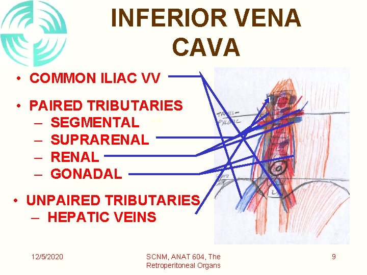 INFERIOR VENA CAVA • COMMON ILIAC VV • PAIRED TRIBUTARIES – SEGMENTAL – SUPRARENAL