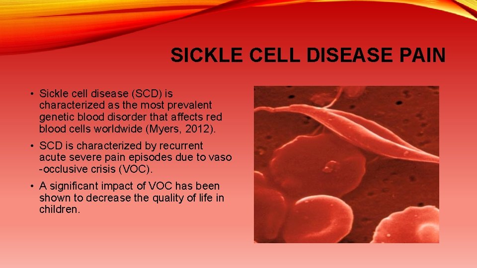 SICKLE CELL DISEASE PAIN • Sickle cell disease (SCD) is characterized as the most