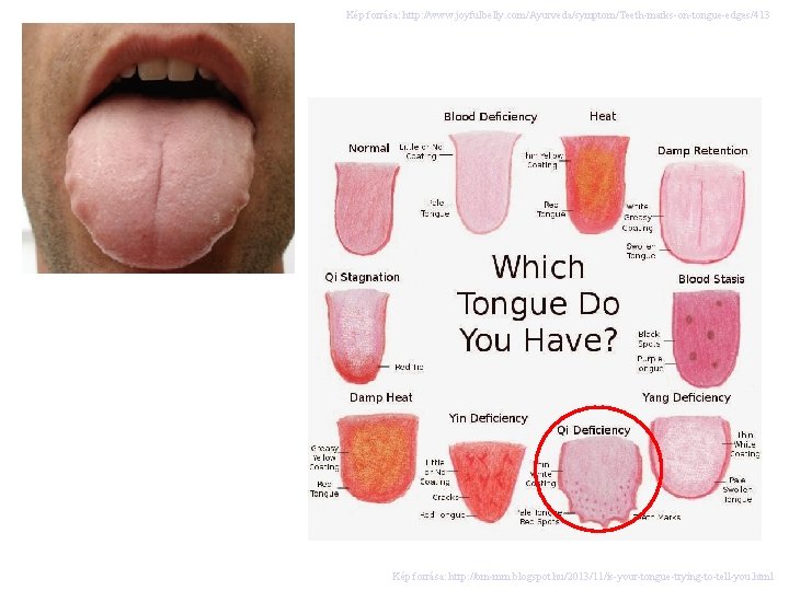 Kép forrása: http: //www. joyfulbelly. com/Ayurveda/symptom/Teeth-marks-on-tongue-edges/413 Kép forrása: http: //bm-mm. blogspot. hu/2013/11/is-your-tongue-trying-to-tell-you. html 