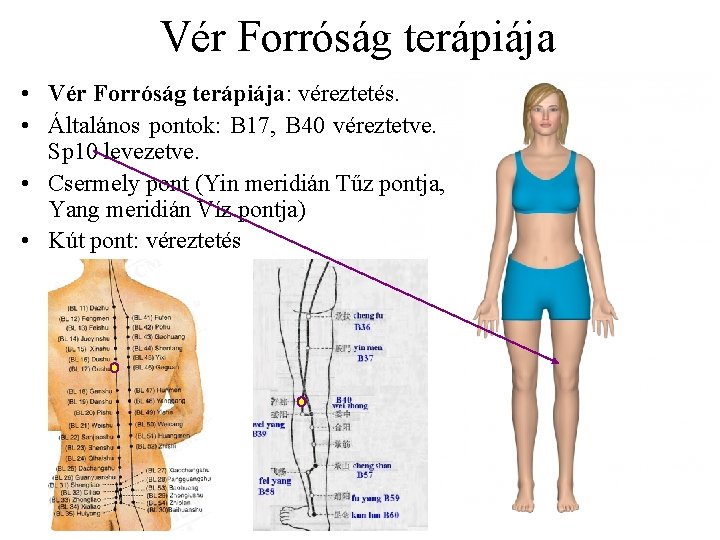 Vér Forróság terápiája • Vér Forróság terápiája: véreztetés. • Általános pontok: B 17, B