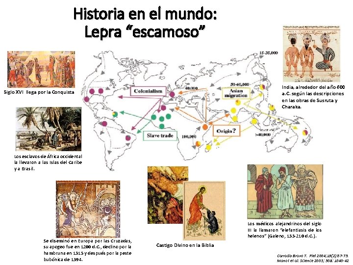 Historia en el mundo: Lepra “escamoso” India, alrededor del año 600 a. C. según