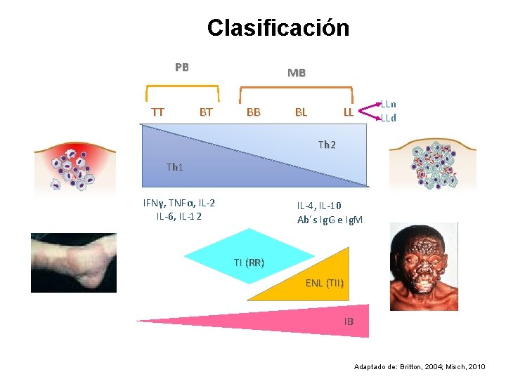 Clasificación PB TT MB BT BB BL LL LLn LLd Th 2 Th 1