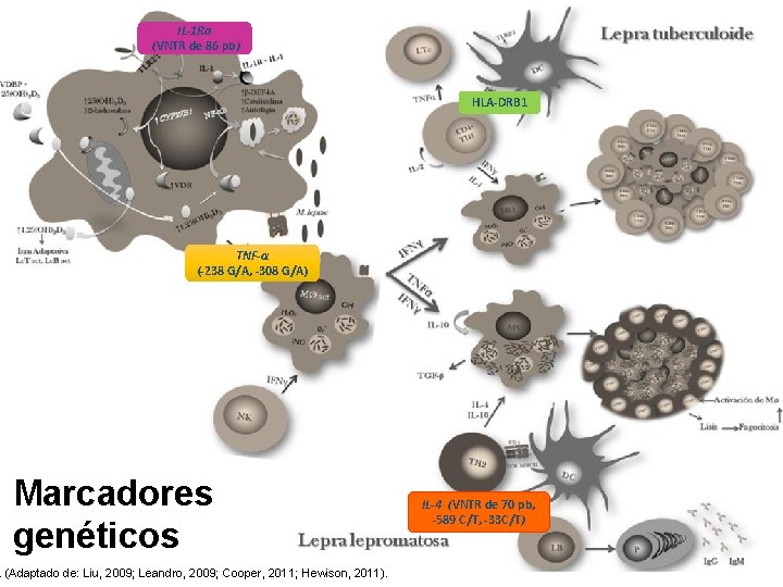 IL-1 Ra (VNTR de 86 pb) HLA-DRB 1 TNF-α (-238 G/A, -308 G/A) Marcadores