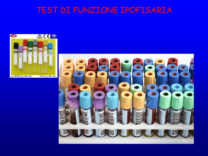 TEST DI FUNZIONE IPOFISARIA 